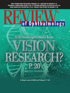 Review Of Ophthalmology - May 2015