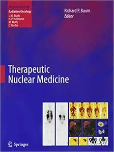 Therapeutic Nuclear Medicine