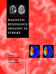 Magnetic Resonance Imaging in Stroke