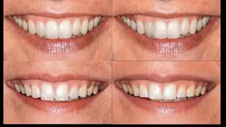 Esthetics With Efficiency