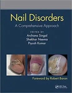 Nail Disorders: A Comprehensive Approach (Repost)