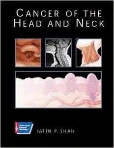 Cancer of the Head and Neck