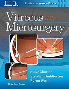 Vitreous Microsurgery (6th Edition)