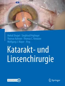 Katarakt- und Linsenchirurgie: in der Augenheilkunde (German Edition)