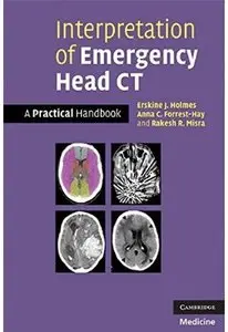 Interpretation of Emergency Head CT: A Practical Handbook