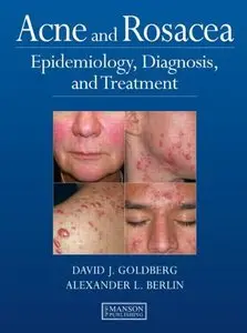 Acne and Rosacea: Epidemiology, Diagnosis and Treatment (repost)