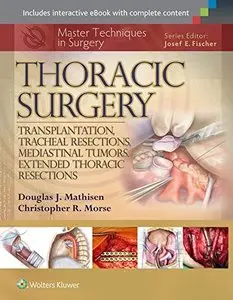 Master Techniques in Surgery: Thoracic Surgery: Transplantation, Tracheal Resections, Mediastinal Tumors...