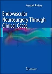 Endovascular Neurosurgery Through Clinical Cases