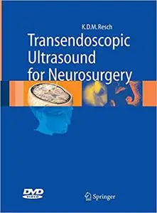 Transendoscopic Ultrasound for Neurosurgery [Repost]