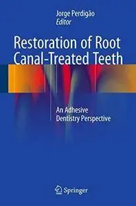 Restoration of Root Canal-Treated Teeth: An Adhesive Dentistry Perspective (repost)