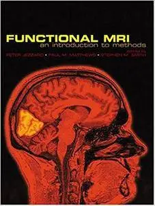 Functional MRI: An Introduction to Methods (Repost)