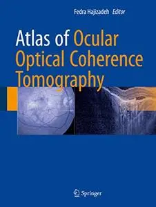 Atlas of Ocular Optical Coherence Tomography (Repost)