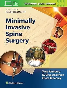 Minimally Invasive Spine Surgery