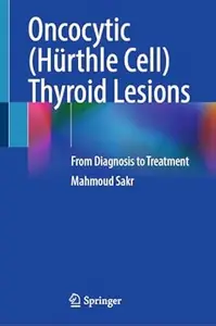 Oncocytic (Hürthle Cell) Thyroid Lesions: From Diagnosis to Treatment