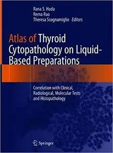 Atlas of Thyroid Cytopathology on Liquid-Based Preparations
