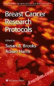 Breast Cancer Research Protocols (Methods in Molecular Medicine)