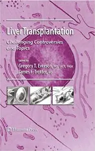 Liver Transplantation: Challenging Controversies and Topics (Repost)