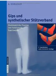 Gips und synthetischer Stützverband: Herkömmliche Fixation und funktionelle Stabilisation (Auflage: 2)