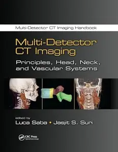 Multi-Detector CT Imaging: Principles, Head, Neck, and Vascular Systems (Repost)