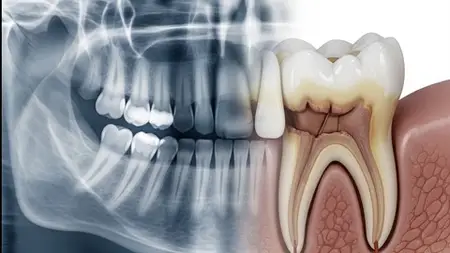 Dental Radiography Interpretation & Diagnosis Course