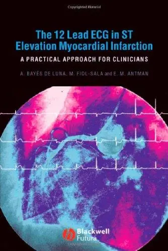 The 12 Lead ECG in ST Elevation Myocardial Infarction: A Practical Approach for Clinicians