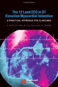 The 12 Lead ECG in ST Elevation Myocardial Infarction: A Practical Approach for Clinicians (Repost)