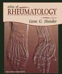 Atlas of Rheumatology, Second Edition