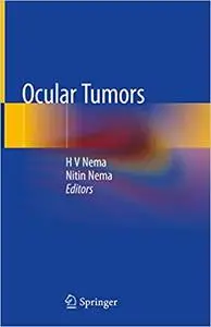 Ocular Tumors