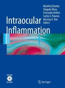 Intraocular Inflammation