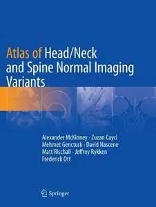 Atlas of Head/Neck and Spine Normal Imaging Variants (Repost)