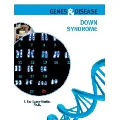 Down Syndrome (Genes and Disease)