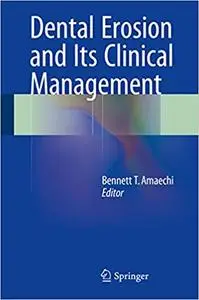 Dental Erosion and Its Clinical Management (Repost)