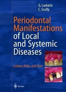 Periodontal Manifestations of Local and Systemic Diseases: Colour Atlas and Text