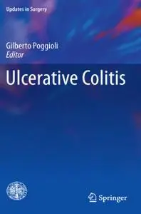 Ulcerative Colitis