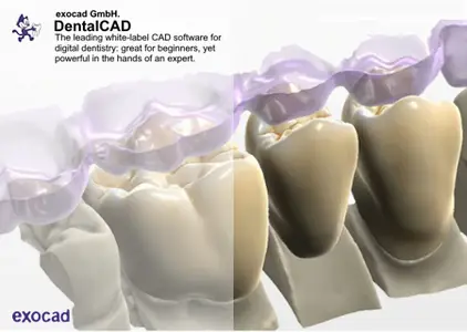 exocad DentalCAD 3.2 Elefsina (9036)