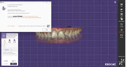 exocad DentalCAD 3.2 Elefsina (9036)