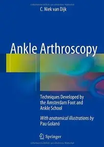 Ankle Arthroscopy: Techniques Developed by the Amsterdam Foot and Ankle School (Repost)