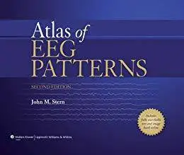 Atlas of EEG Patterns [Repost]