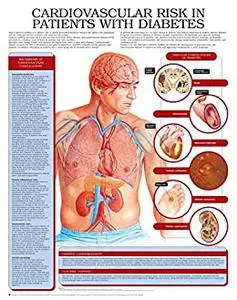 Cardiovascular risk in patients with diabetes e chart: Full illustrated