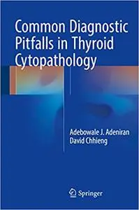 Common Diagnostic Pitfalls in Thyroid Cytopathology (Repost)