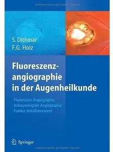 Fluoreszenzangiographie in der Augenheilkunde [Repost]
