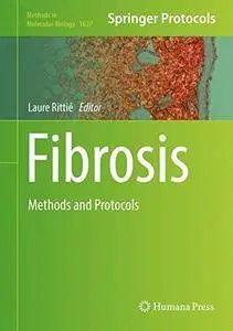 Fibrosis: Methods and Protocols (Methods in Molecular Biology)