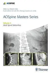 Aospine Masters Series, Volume 4: Adult Spinal Deformities (Repost)