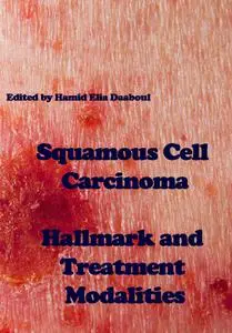 "Squamous Cell Carcinoma: Hallmark and Treatment Modalities" ed. by Hamid Elia Daaboul