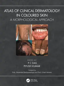 Atlas of Clinical Dermatology in Coloured Skin: A Morphological Approach