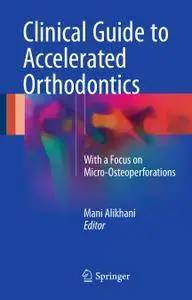 Clinical Guide to Accelerated Orthodontics: With a Focus on Micro-Osteoperforations