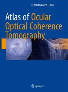 Atlas of Ocular Optical Coherence Tomography (Repost)