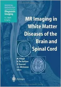 MR Imaging in White Matter Diseases of the Brain and Spinal Cord by Massimo Filippi