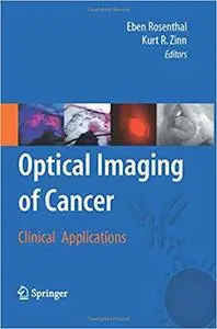 Optical Imaging of Cancer: Clinical Applications (Repost)