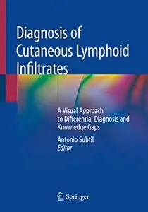 Diagnosis of Cutaneous Lymphoid Infiltrates: A Visual Approach to Differential Diagnosis and Knowledge Gaps (Repost)